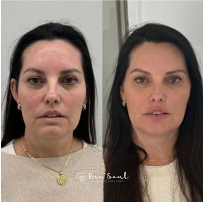 Estética Bio Soul